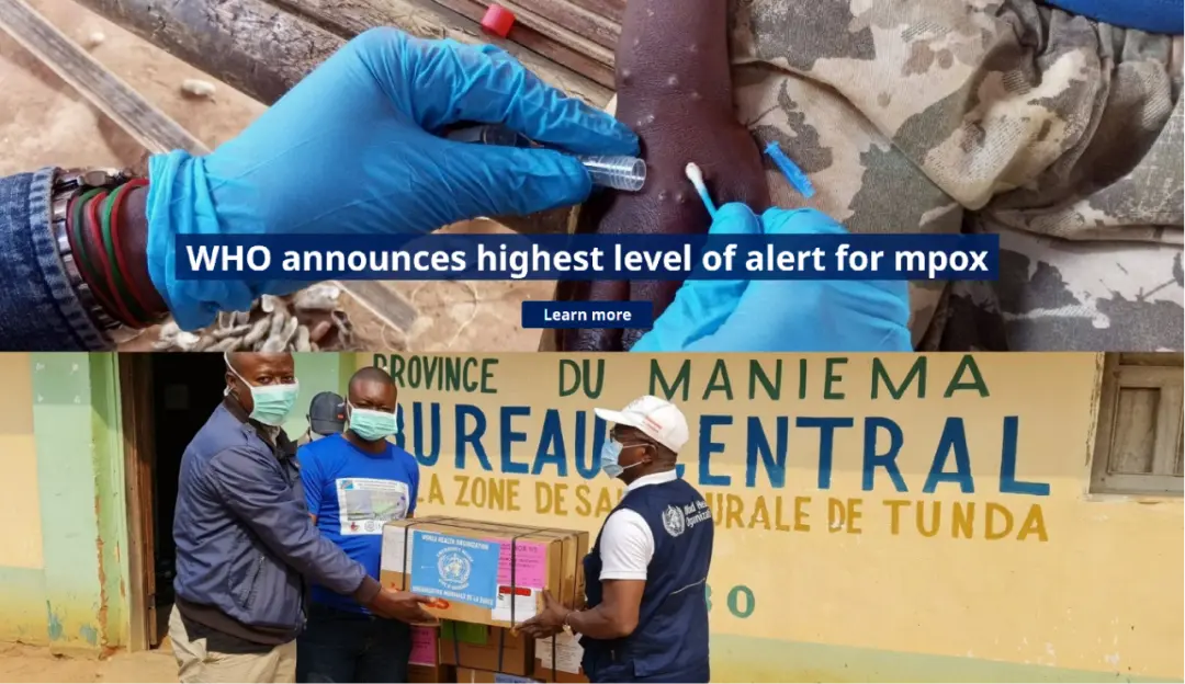 iGeneTech Empowers Precision Detection and Traceability of Monkeypox Virus