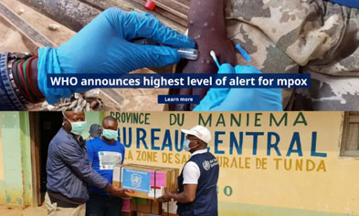 iGeneTech Empowers Precision Detection and Traceability of Monkeypox Virus