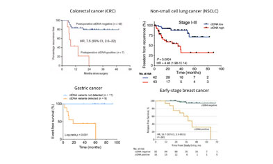 Overview of the Origin and Current Situation of Minimal Residual Disease (MRD) in Solid Tumors