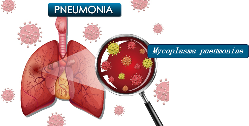 iGeneTech Precision Traceability, Early Detection of Mycoplasma pneumoniae iGeneTech Precision Traceability, Early Detection of Mycoplasma pneumoniae