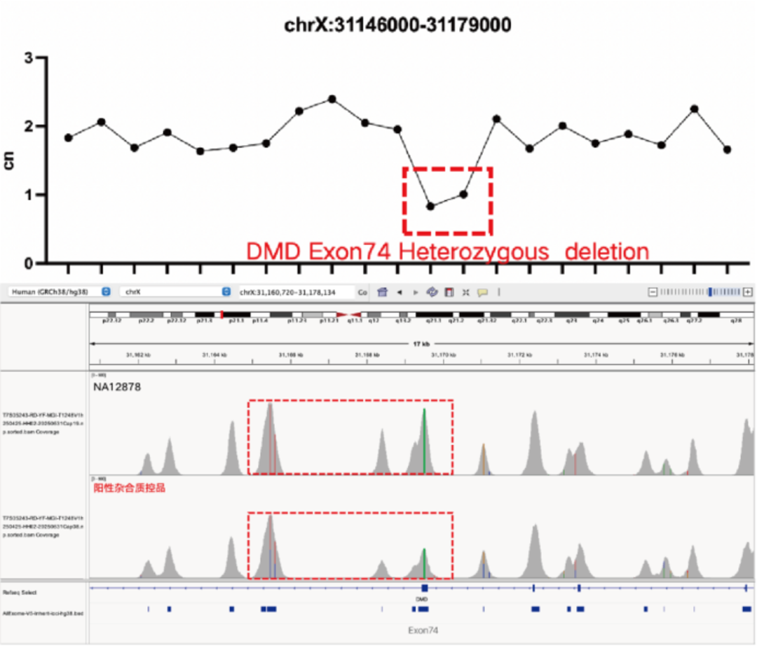 AIExome V5-Inherit Edition is now available!