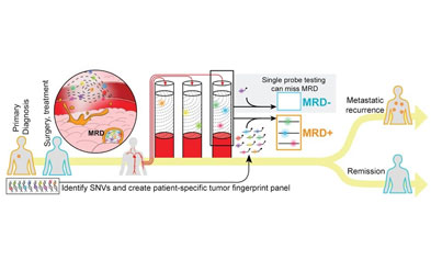 High cost of MRD testing? How to overcome the predicament and enhance the clinical value of tumor diagnosis and treatment.