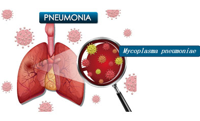 iGeneTech Precision Traceability, Early Detection of Mycoplasma pneumoniae