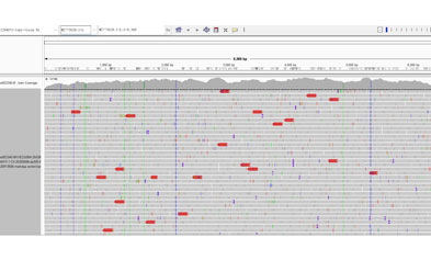 iGeneTech's multiplex virus detection solution accurately addresses multiple threats such as Yellow Fever and Zika