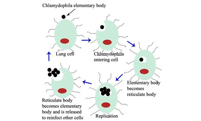 IGT: Precise Traceability, Early Detection of Chlamydia psittaci