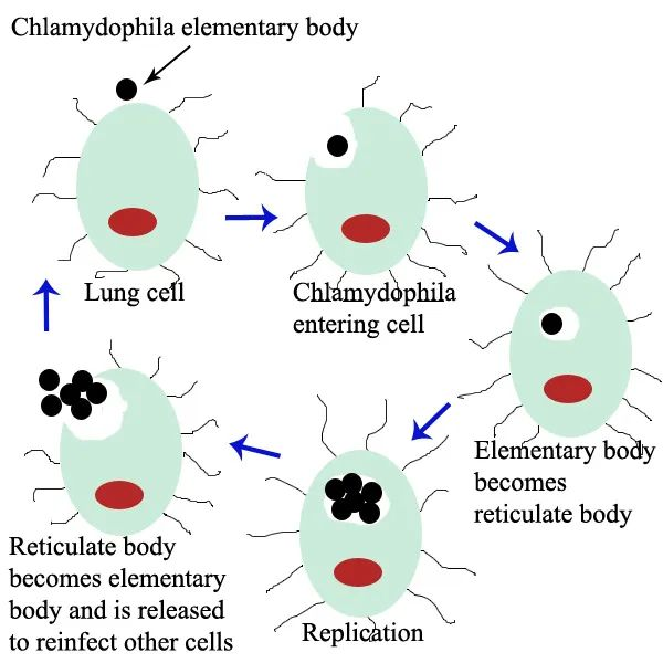 IGT: Precise Traceability, Early Detection of Chlamydia psittaci IGT: Precise Traceability, Early Detection of Chlamydia psittaci