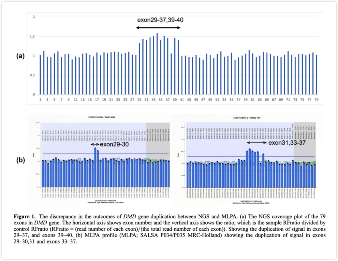 iGeneTech Helped Its Client(s) Publish Research Findings in Journal of Genetics: NGS Technology Identifies Novel DMD Gene Duplication Variants iGeneTech Helped Its Client(s) Publish Research Findings in Journal of Genetics: NGS Technology Identifies Novel DMD Gene Duplication Variants