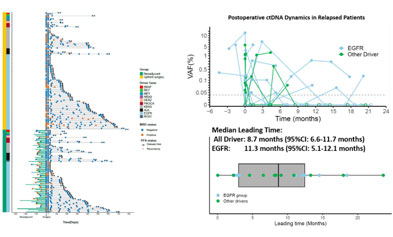 The clinical value of MRD testing is clear—yet why is it difficult for doctors to apply it in practice?